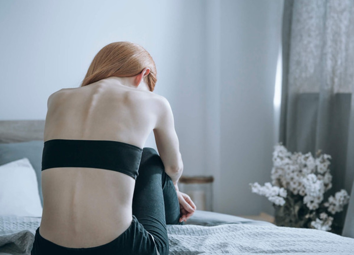 Disturbi alimentari, dal cibo alla depressione: cresce l’allarme tra i giovani Disturbi alimentari, dal cibo alla depressione: cresce l’allarme tra i giovani