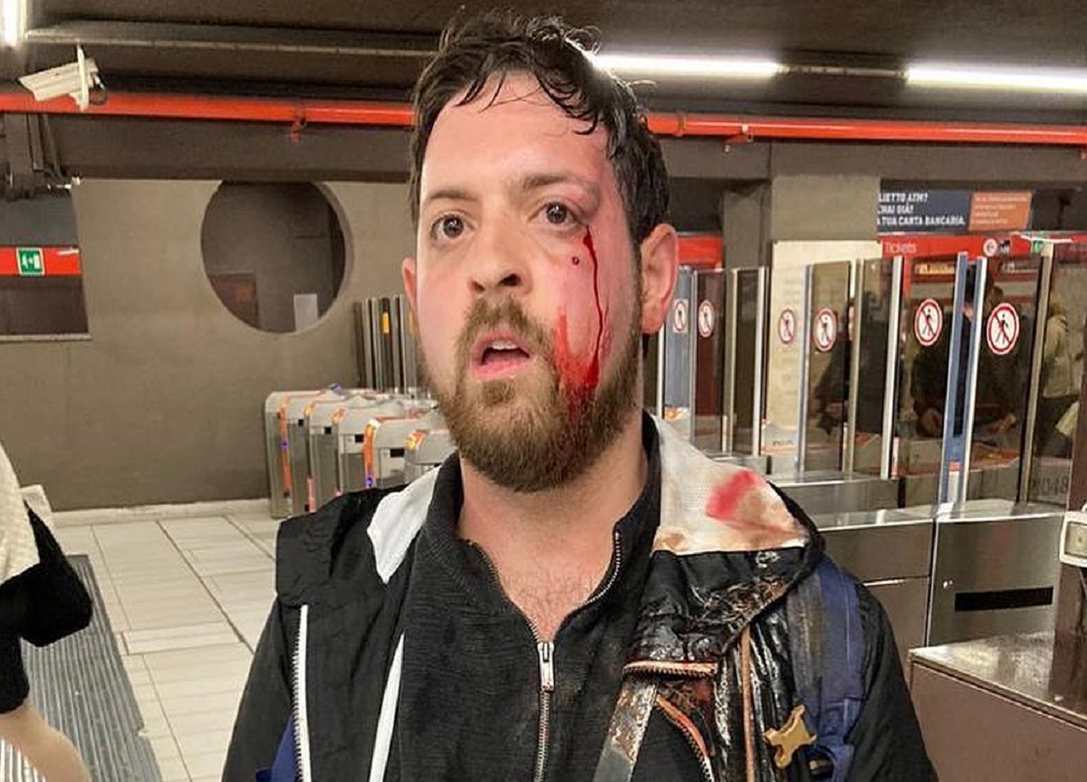 Milano, riprende le borseggiatrici in metro: gli sferrano un pugno in faccia Milano, riprende le borseggiatrici in metro: gli sferrano un pugno in faccia