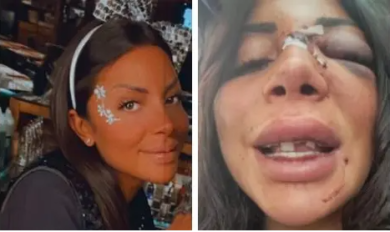 Prato, Martina Mucci sfregiata per gelosia: arrestato l’ex ragazzo