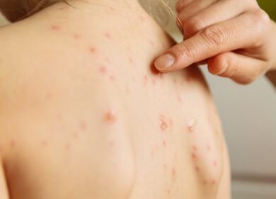 La minaccia di una nuova epidemia, paura per il virus: ecco quale