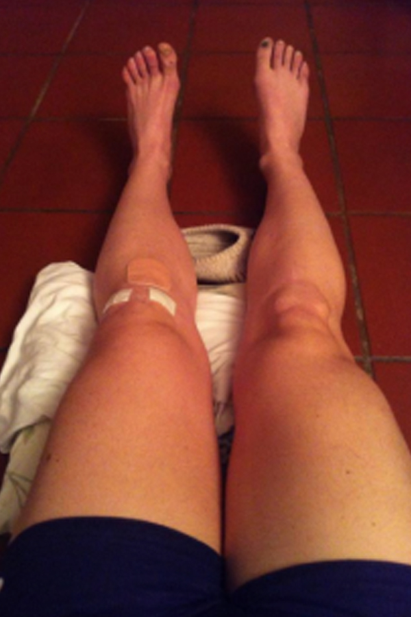 Sofia Goggia sfida gli haters: “I miei piedi non sono belli, ma valgono”