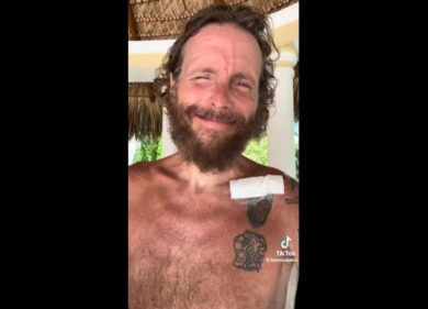 Jovanotti irriconoscibile dopo l’incidente: “Rischio la trombosi”