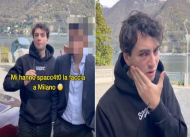 Eddy Beef, il tiktoker aggredito: “Mi hanno spaccato la faccia a Milano”