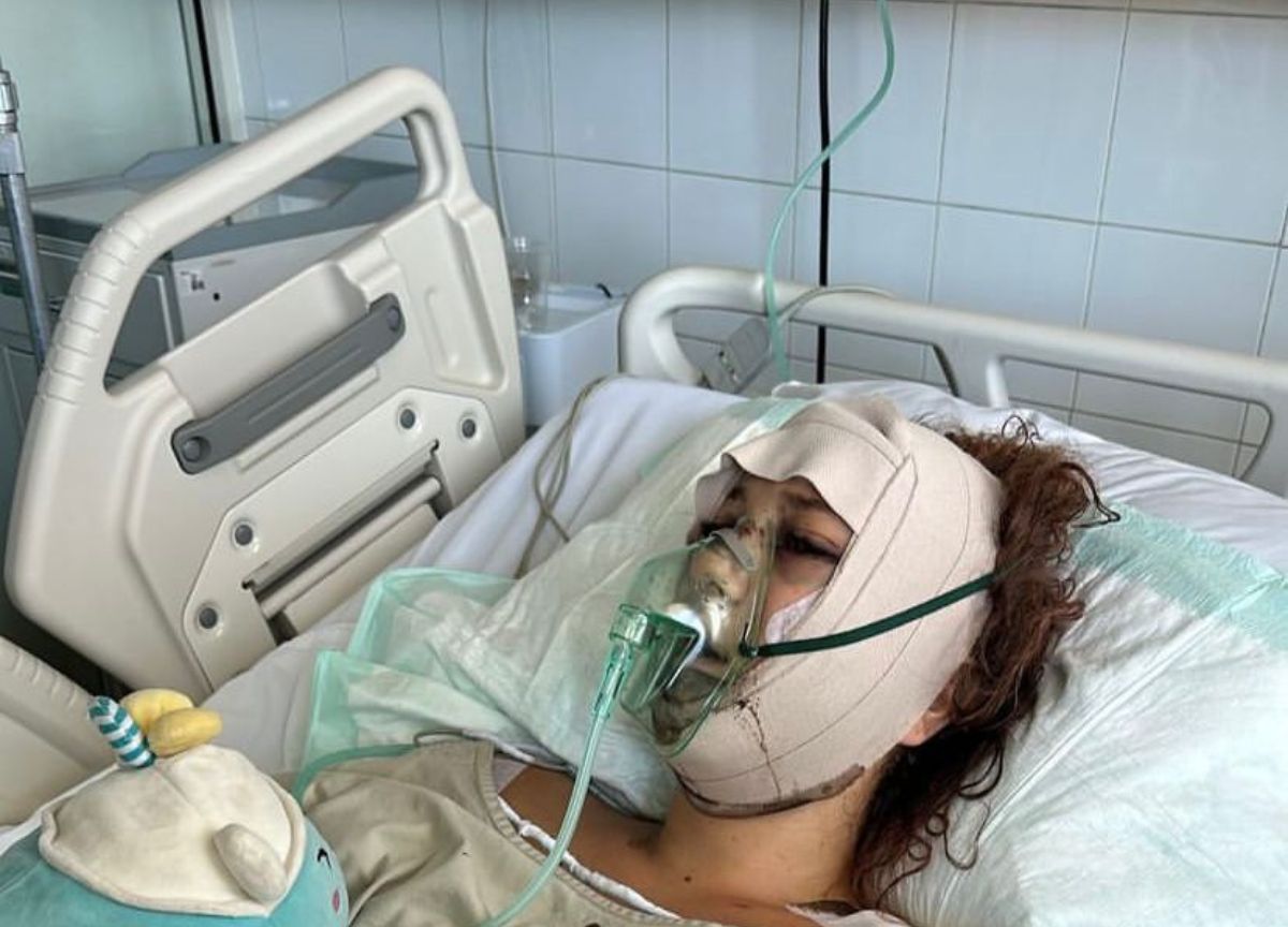 Travolta da un’auto a Bali 22enne di Chiavenna. Raccolta fondi da 100mila euro Travolta da un’auto a Bali 22enne di Chiavenna. Raccolta fondi da 100mila euro