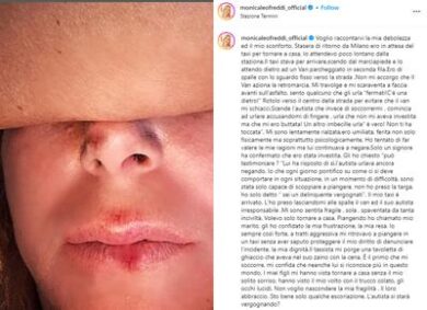 Monica Leoffredi investita da un van: “L’autista mi ha accusata di fingere”