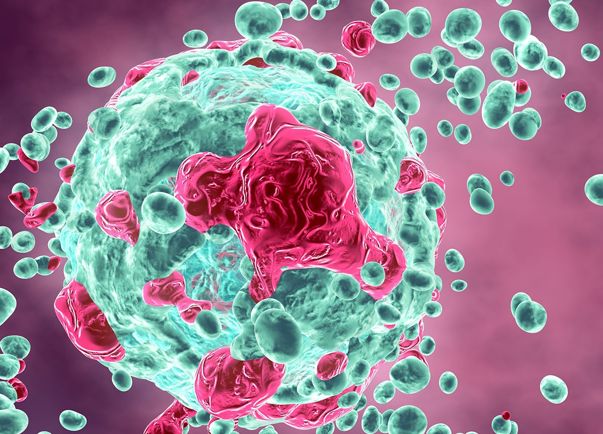 Tumore al polmone: ecco il farmaco che blocca la progressione della malattia Tumore al polmone: ecco il farmaco che blocca la progressione della malattia