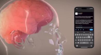Elon Musk: Neuralink ha installato in un essere umano Telepathy, primo impianto cerebrale