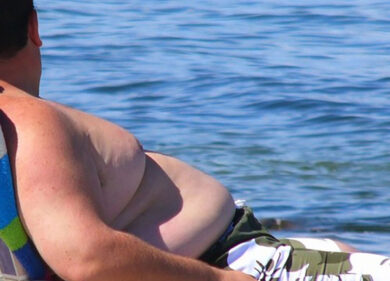 Obesità, allarme in Italia per 4 mln di persone. E i casi in età pediatrica…