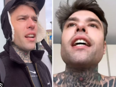 Ferragni, a Fedez non ne va bene una: dente rotto. “Andiamo a Lourdes?”