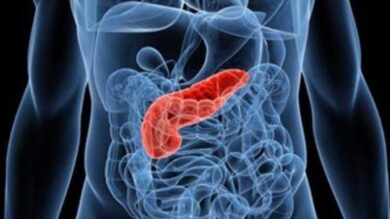 Tumore al pancreas: ecco quali sono i sintomi da non sottovalutare