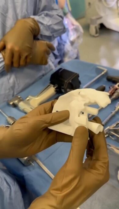 Dolori alla spalla e rimedi, le protesi diventano sempre più ‘custom made’