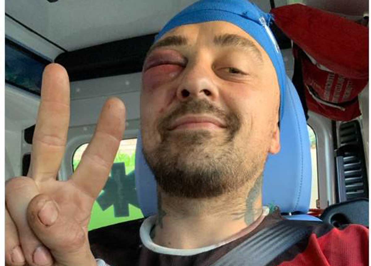 Chef Rubio, dopo l’aggressione le indagini: aperto un fascicolo in Procura Chef Rubio, dopo l’aggressione le indagini: aperto un fascicolo in Procura