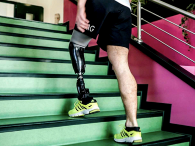 Nuova speranza per chi ha perso un arto: protesi che restituiscono il tatto