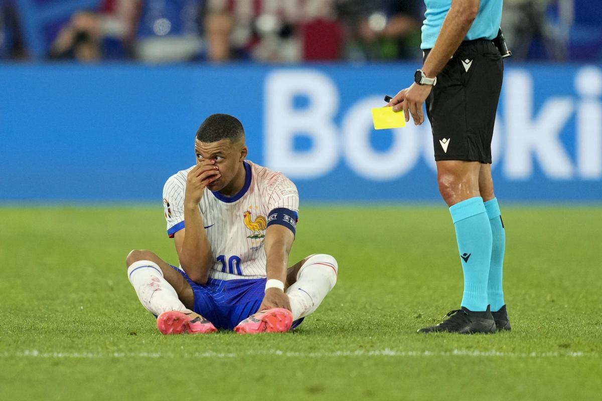 Mbappé naso rotto con l’Austria, ansia Francia a Euro 2024: come sta Kylian Mbappé naso rotto con l’Austria, ansia Francia a Euro 2024: come sta Kylian