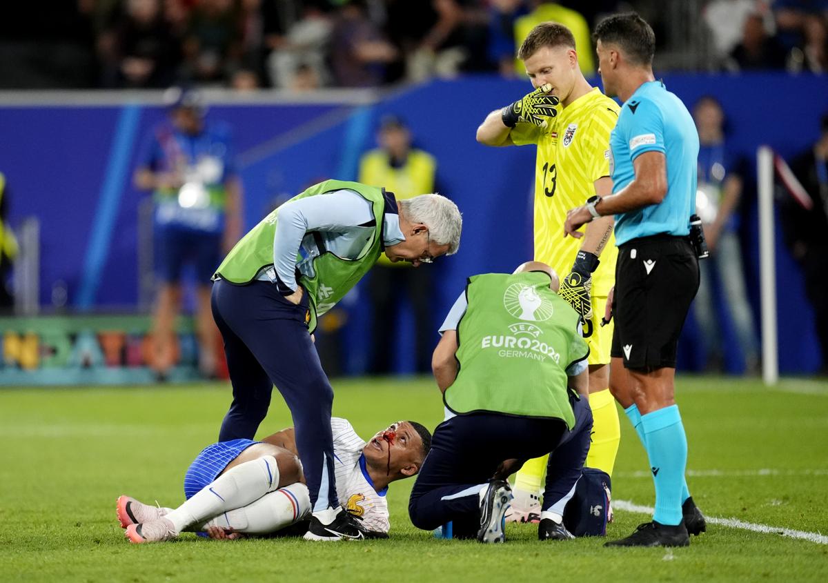 Mbappé naso rotto con l’Austria, ansia Francia a Euro 2024: come sta Kylian Mbappé naso rotto con l’Austria, ansia Francia a Euro 2024: come sta Kylian