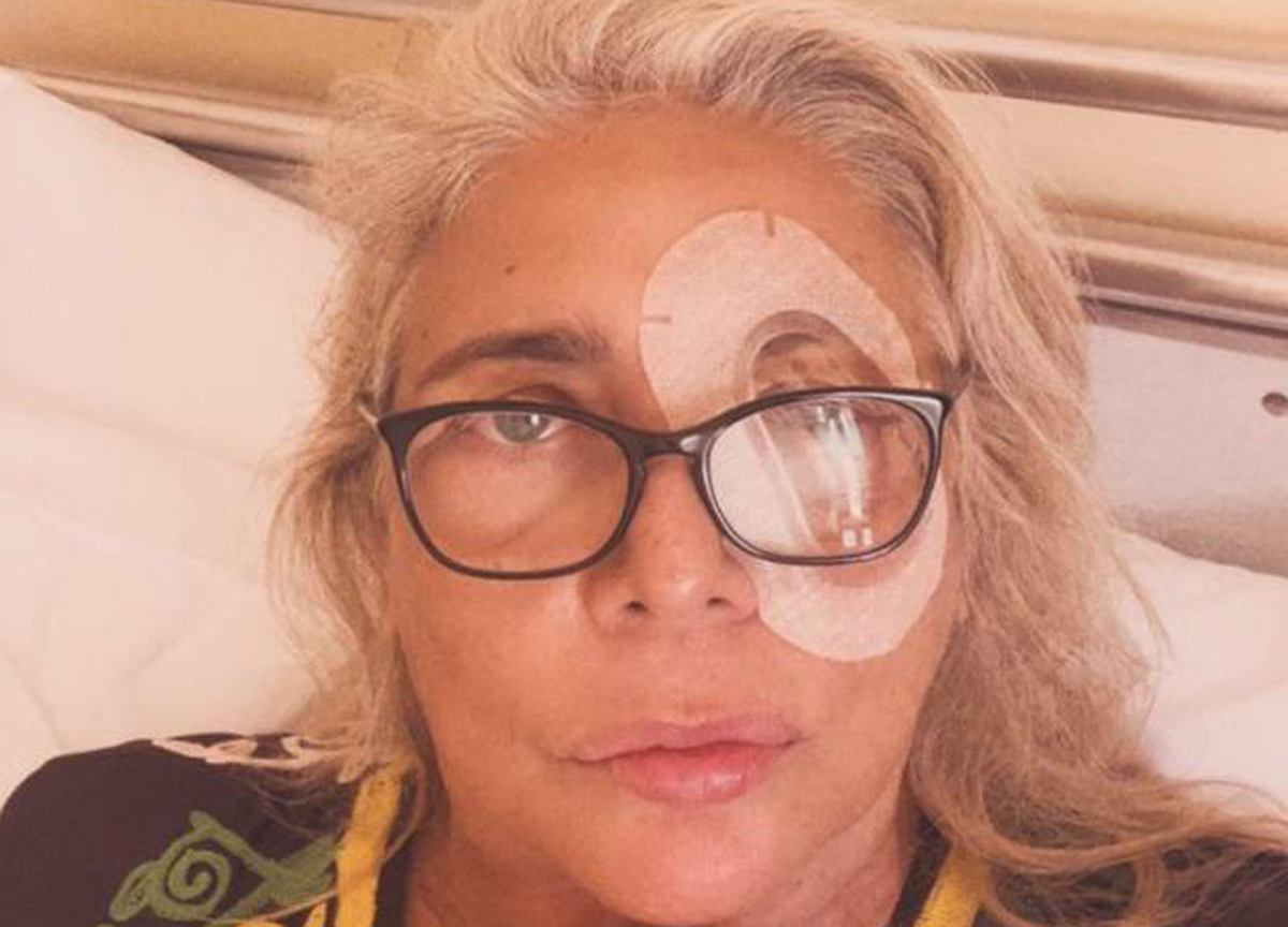 Mara Venier, paura per la conduttrice: operata in clinica all’occhio sinistro Mara Venier, paura per la conduttrice: operata in clinica all’occhio sinistro