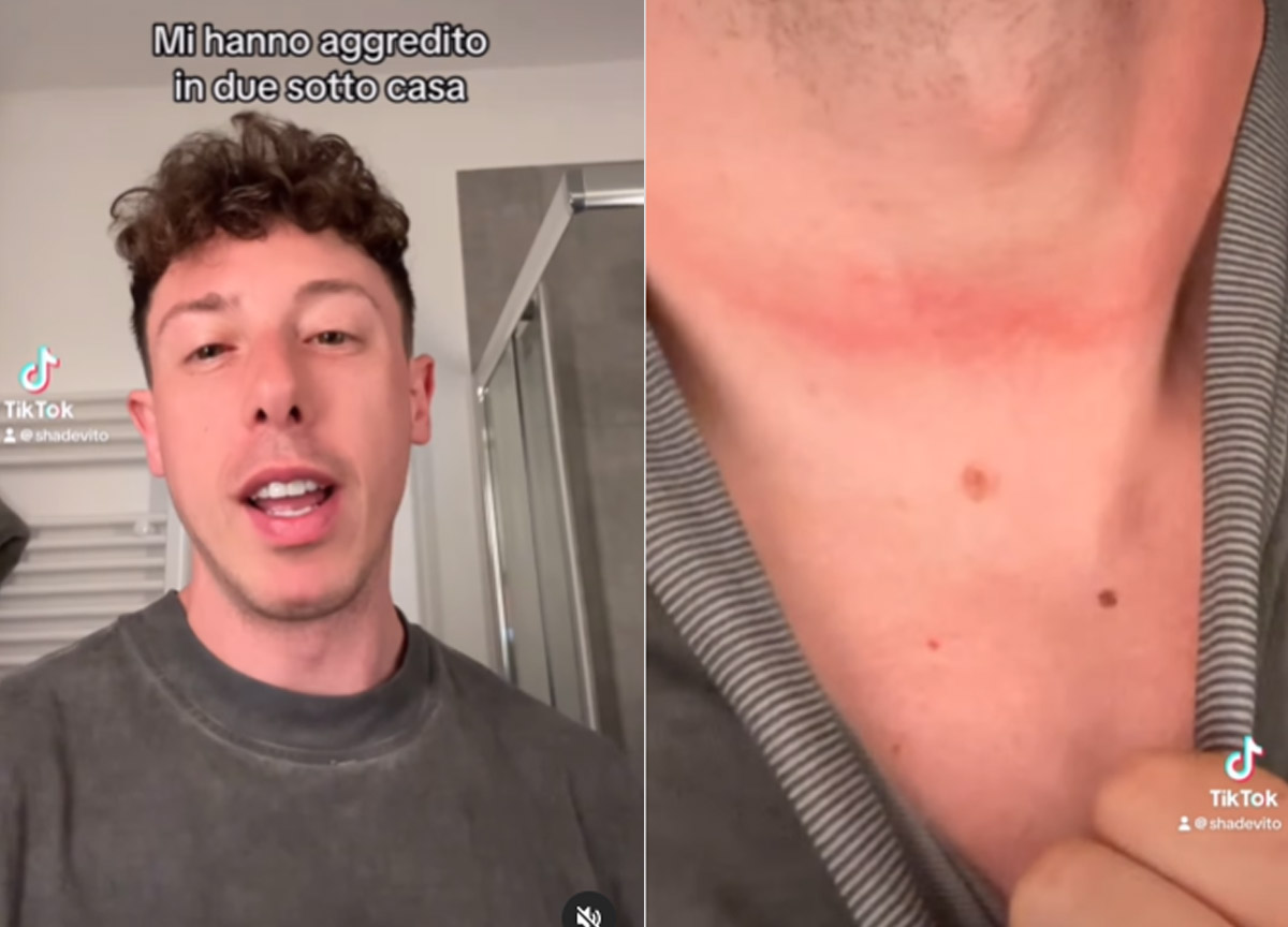 Torino, aggredito il rapper Shade: preso al collo e derubato di una collana da due individui Torino, aggredito il rapper Shade: preso al collo e derubato di una collana da due individui
