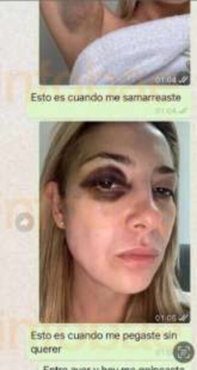 L’ex premier argentino Alberto Fernandez denunciato per violenza dall’ex moglie Fabiola Yanez