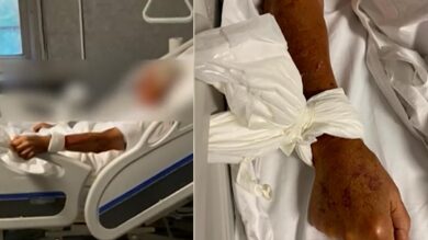 Anziani legati ai letti dell’ospedale con le lenzuola: è polemica a Napoli