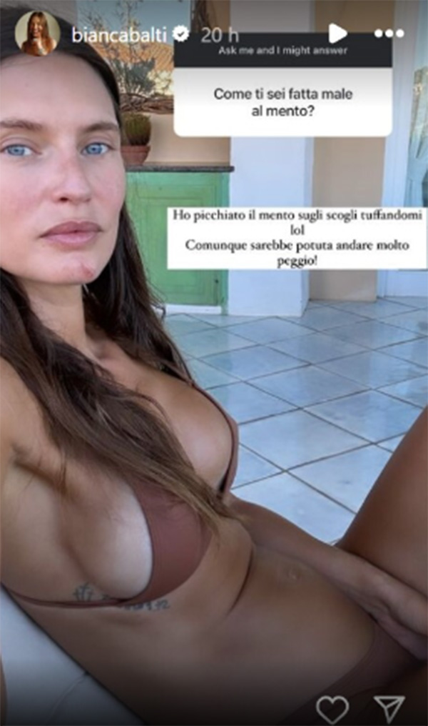 Bianca Balti operata per un cancro ovarico al terzo stadio: “Ho un lungo viaggio davanti a me” Bianca Balti operata per un cancro ovarico al terzo stadio: “Ho un lungo viaggio davanti a me”