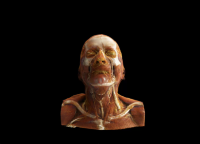 Siemens Healthineers lancia il Cinematic Rendering e un’app per Apple Vision Pro