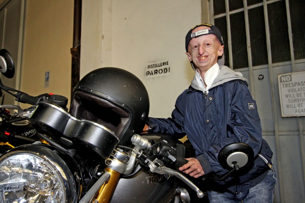 Progeria, Sammy Basso verso la beatificazione. Il vescovo: “Nella sua vita ordinaria c’era santità” Progeria, Sammy Basso verso la beatificazione. Il vescovo: “Nella sua vita ordinaria c’era santità”
