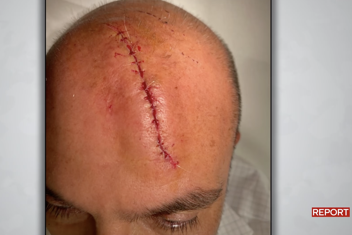 Ascolti tv, Report (con caso Sangiuliano) mostruoso! Che tempo che fa di Fazio e Le Iene sbaragliati. Berlinguer (ancora) male Ascolti tv, Report (con caso Sangiuliano) mostruoso! Che tempo che fa di Fazio e Le Iene sbaragliati. Berlinguer (ancora) male