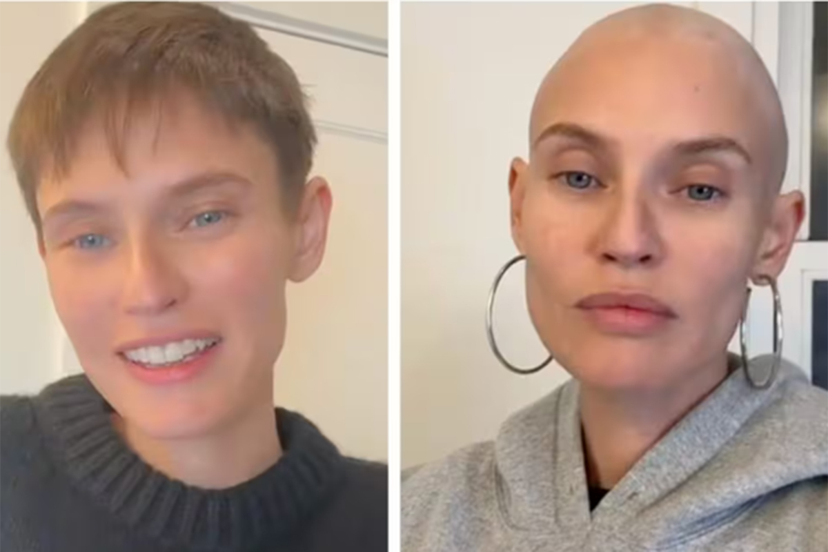 Bianca Balti senza capelli. “Ops, l’ho fatto”. Il video post chemio diventa virale Bianca Balti senza capelli. “Ops, l’ho fatto”. Il video post chemio diventa virale