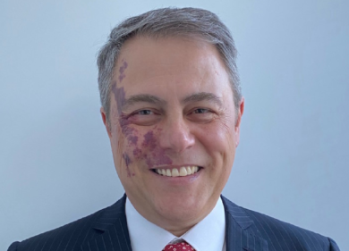 Open Fiber e Unifiber: siglato accordo per il Piano ‘Italia a 1 Giga’ nel Lazio