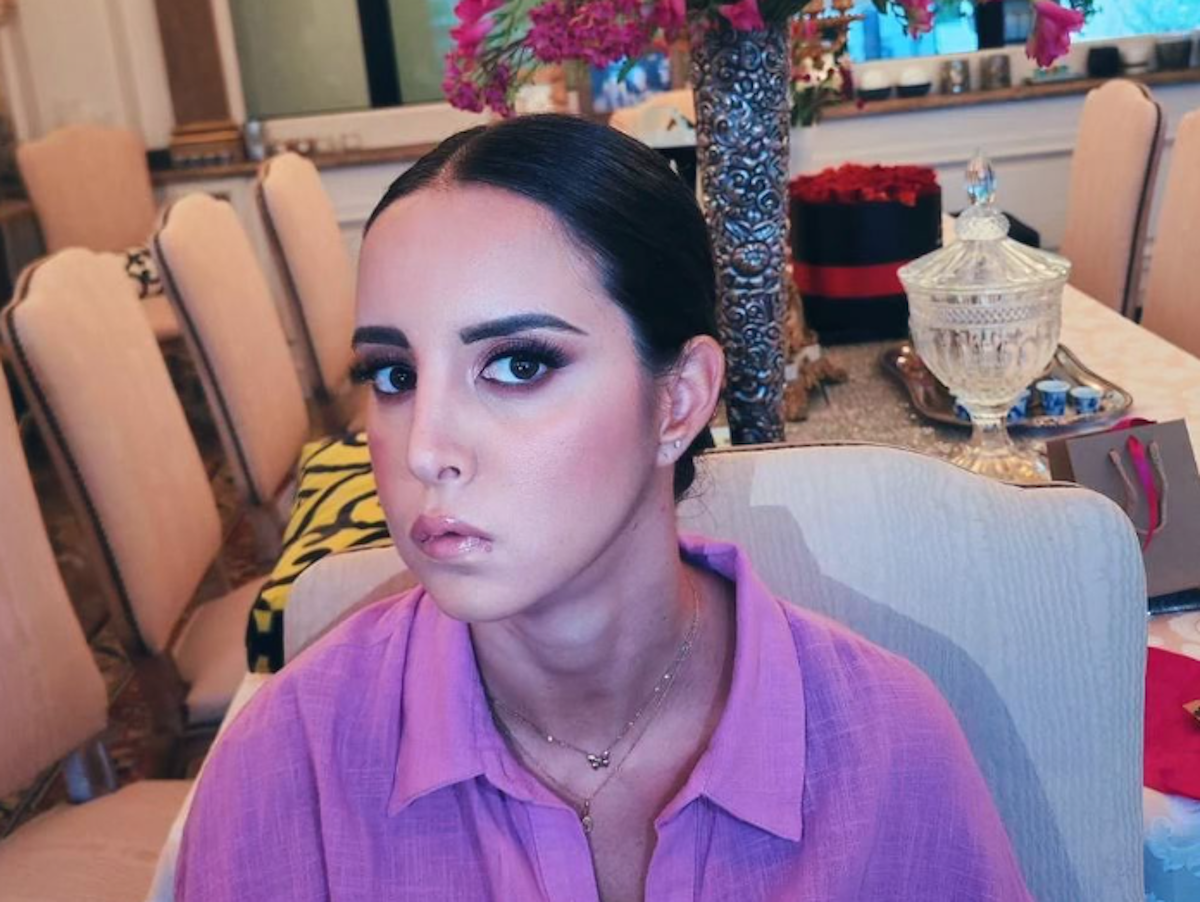 Chi è Camilla Mancini: la figlia del ct racconta a Le Iene il bullismo subito per la sua malformazione