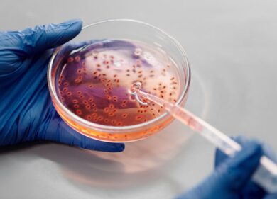 Virus del Congo, rientrato l’allarme per il paziente di Lucca: resta l’allerta focolai