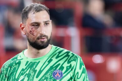 Donnarumma choc: tacchetti in faccia da Singo esce sanguinante: 10 punti sul volto – LE FOTO