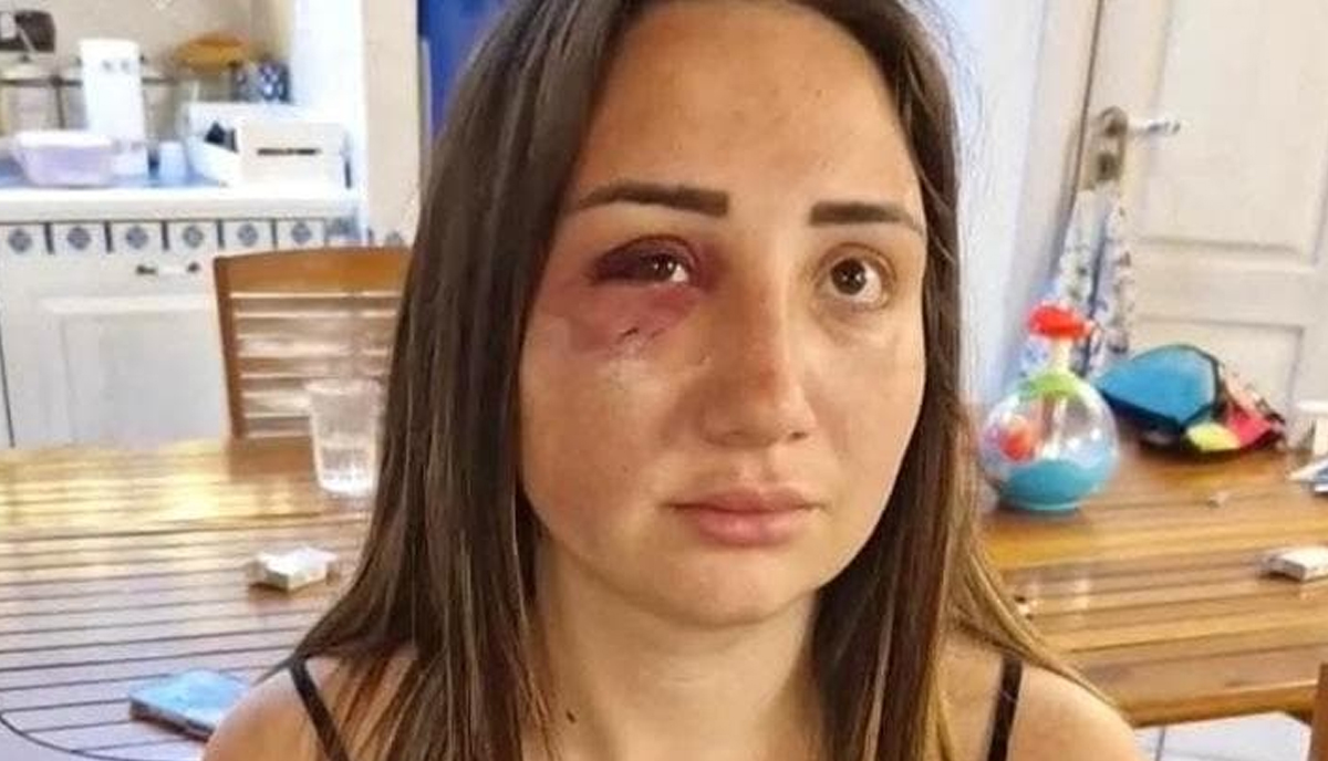 Tentato omicidio a Pozzuoli: “Ecco come ha cercato di uccidermi, con l’aiuto degli amici” Tentato omicidio a Pozzuoli: “Ecco come ha cercato di uccidermi, con l’aiuto degli amici”