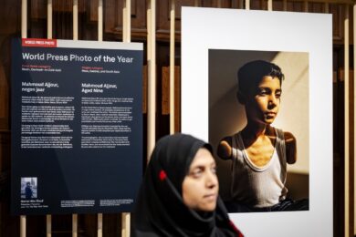 World Press Photo, il bambino amputato a Gaza è la foto dell’anno. Il ritratto della guerra
