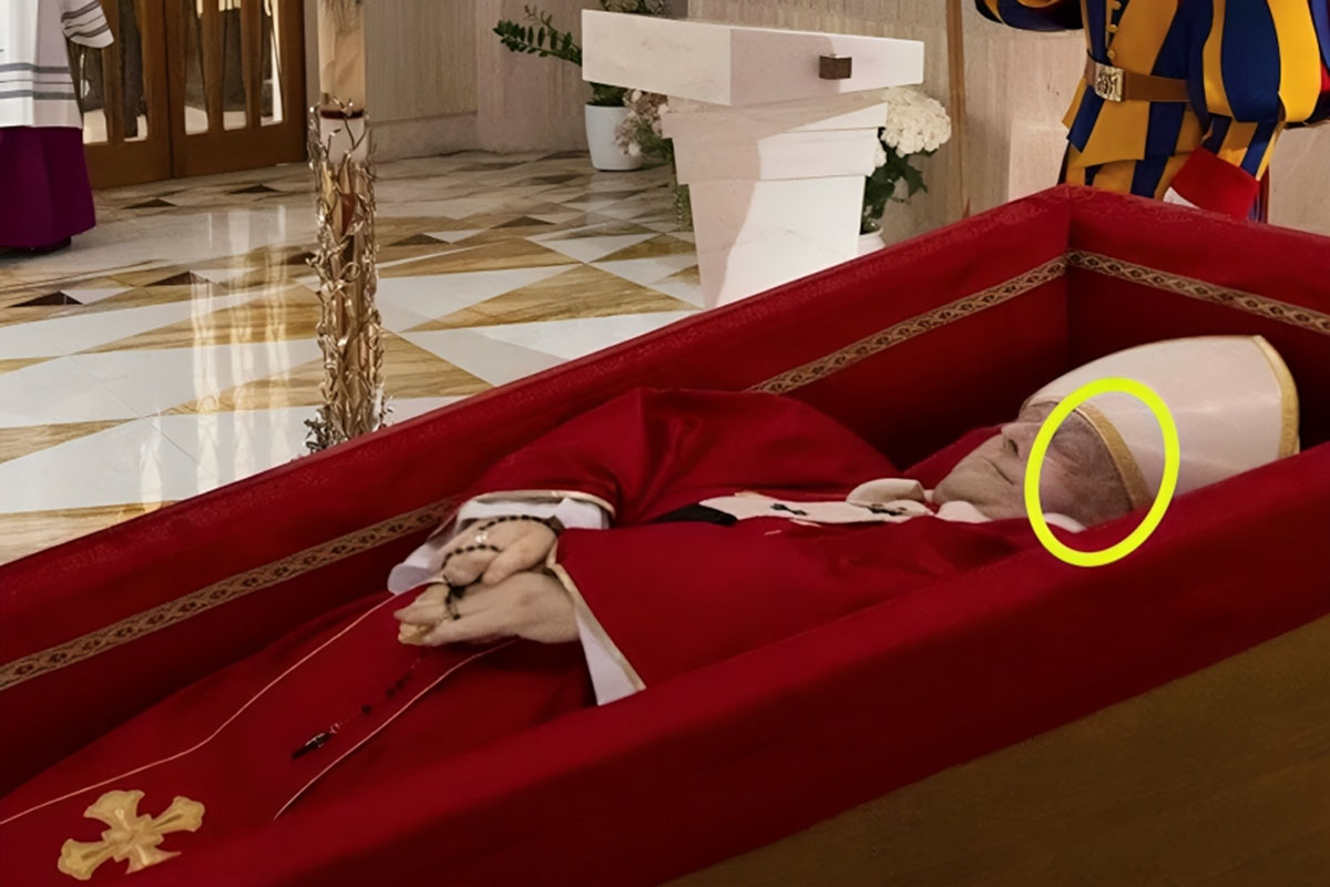 Morte Papa Francesco: l’ematoma sull’orbita sinistra “per un urto o una caduta”. Ipotesi choc del chirurgo Iannetti