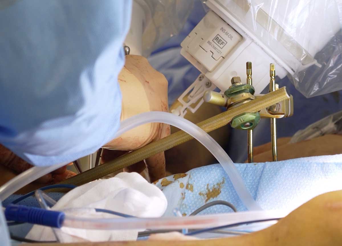 Il robot chirurgo arriva al San Camillo di Roma, ricostruita una gamba con una tecnica di microchirurgia