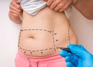 Liposuzione fatale, una paziente esce allo scoperto: “Stavo per morire anch’io, avevo la febbre a 41”