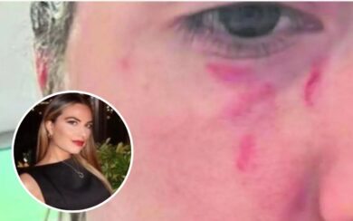 Pamela: il referto medico della precedente aggressione: le violenze, la presenza dei carabinieri e la mancata denuncia