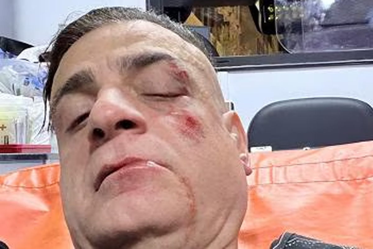 Cicalone aggredito: “Infami veri, da dietro in 10”. Lo youtuber preso a pugni in faccia in metro a Roma dai borseggiatori Cicalone aggredito: “Infami veri, da dietro in 10”. Lo youtuber preso a pugni in faccia in metro a Roma dai borseggiatori