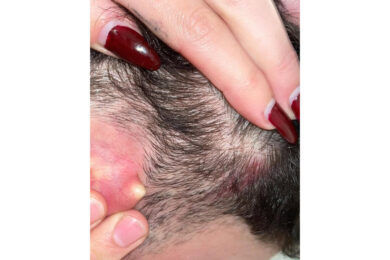 Acca Larentia e l’assalto ai militanti di Gioventù Nazionale, parla uno dei ragazzi aggrediti: “Poteva finire molto peggio”. La testimonianza