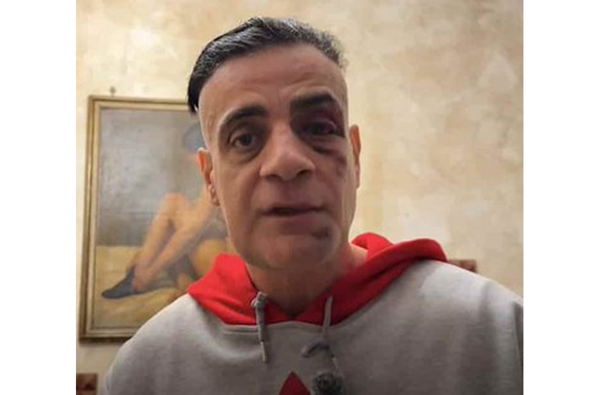 Cicalone aggredito nella stazione metro Ottaviano di Roma: arrestato in Finlandia un uomo, caccia ad altri tre complici Cicalone aggredito nella stazione metro Ottaviano di Roma: arrestato in Finlandia un uomo, caccia ad altri tre complici