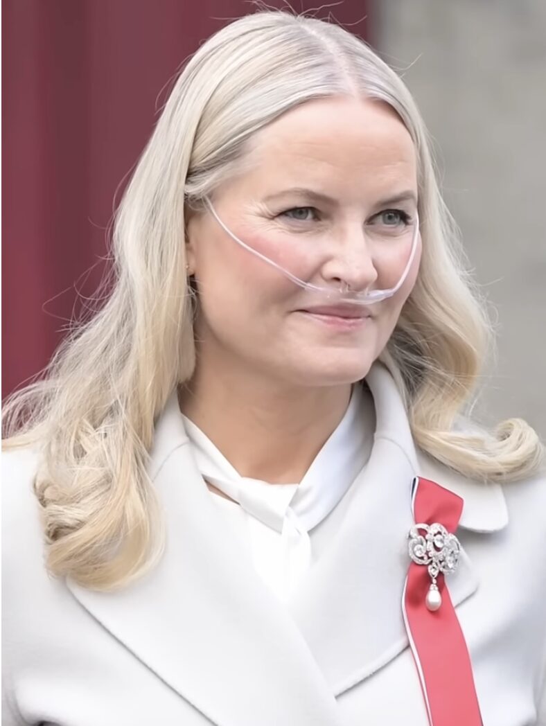 Norvegia, trapianto di polmoni riuscito per la principessa ereditaria Mette-Marit