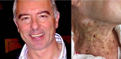 L’appello del professor Rongioletti (San Raffaele): “Basta fake news sul sole. Negare i rischi dei raggi UV significa fare danni”