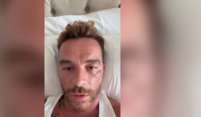 Salmo: “Ho il cancro alla pelle, ecco le cicatrici”. E poi scoppia il caos sull’uso delle creme solari- VIDEO